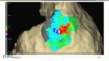 Presentation thumbnail