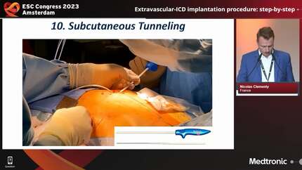 Presentation thumbnail