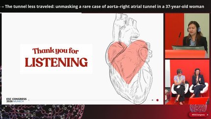 The tunnel less traveled: unmasking a rare case of aorta–right atrial tunnel in a 37-year-old woman