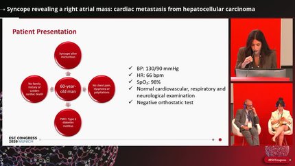 Complications of cardiac masses