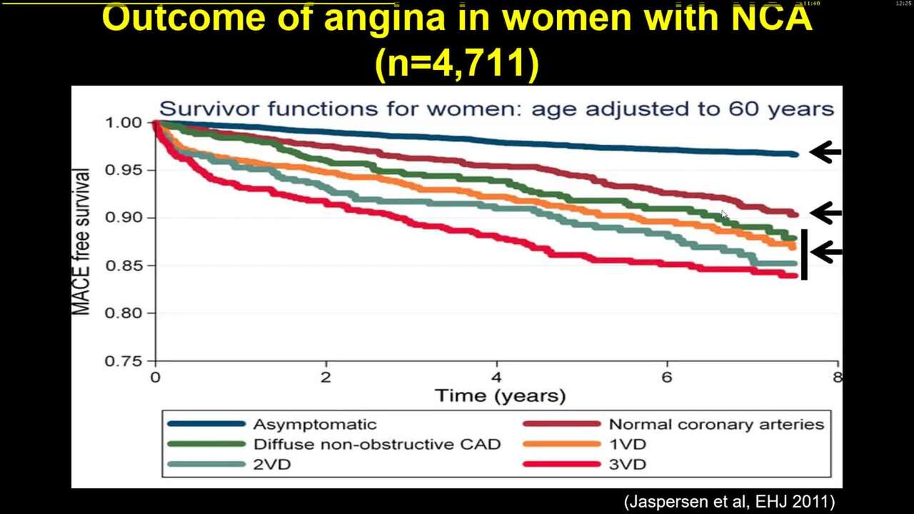 Coronary microvascular dysfunction as a cause of recurrent chest pain in the emergency department.