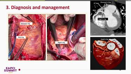 Presentation thumbnail