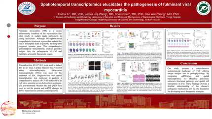 Spatiotemporal transcriptomics elucidates the pathogenesis of fulminant viral myocarditis
