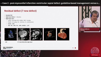 Case 2 - post-myocardial infarction ventricular septal defect: guideline-based management versus slovak challenges