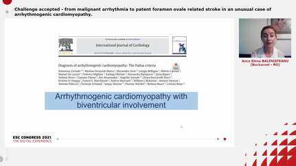 Challenge accepted - from malignant arrhythmia to patent foramen ovale related stroke in an unusual case of arrhythmogenic cardiomyopathy.
