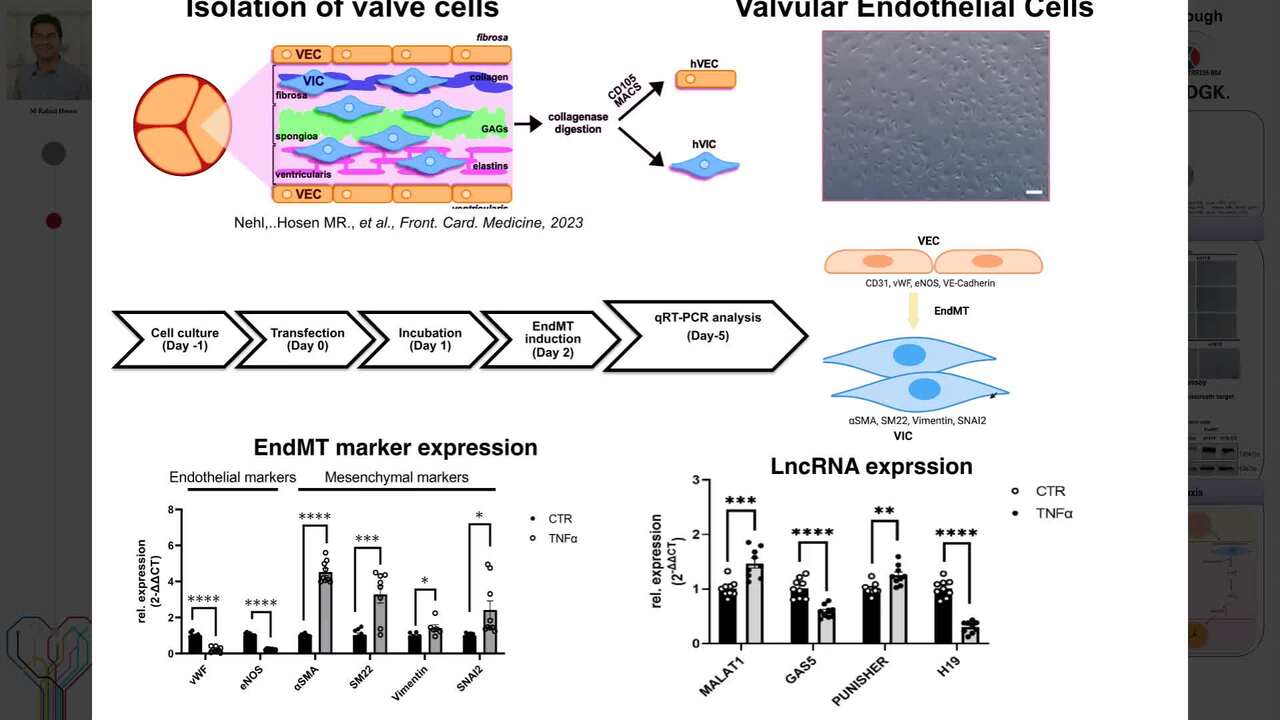 Aortic valve stenosis augments long noncoding RNA H19 to govern angiogenic responses and phenotypes of valvular endothelial cell through endothelial to mesenchymal transition