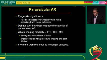 Imaging in complex TAVI cases - Introduction to the session
