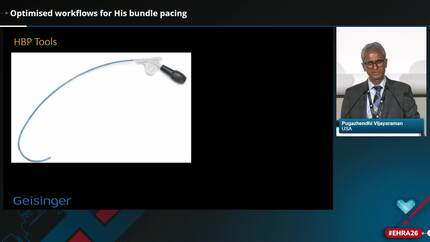 Streamlining pacing therapy: optimised workflows for enhanced efficiency