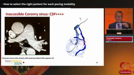 Presentation thumbnail