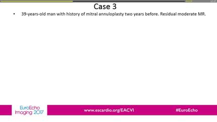 Difficult diagnosis and special characterisitics of mycobacterium chimaera endocarditis.