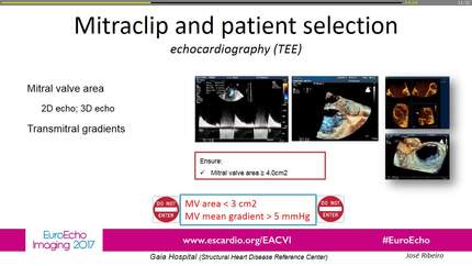 Mitraclip selection and intraprocedure guidance with TEE