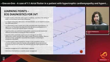 One-on-One – A case of 1:1 Atrial flutter in a patient with hypertrophic cardiomyopathy and hyperthyroidism