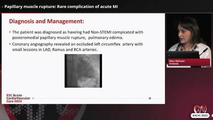 Papillary muscle rupture: Rare complication of acute MI