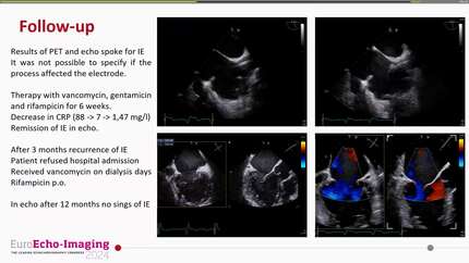 Infective endocarditis in a patient with cardiac implantable electrical device and dialysis catheter - difficulties in differential diagnosis