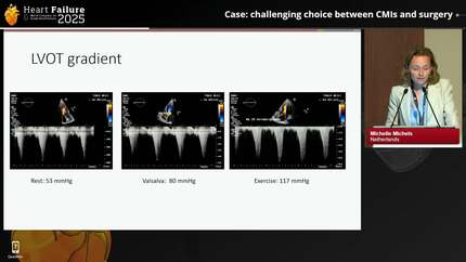 Presentation thumbnail
