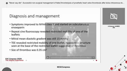 "Never say die"- Successful non-surgical management of failed thrombolysis of prosthetic heart valve thrombosis after bolus intravenous tenecteplase.