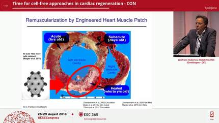 Time for cell-free approaches in cardiac regeneration - CON