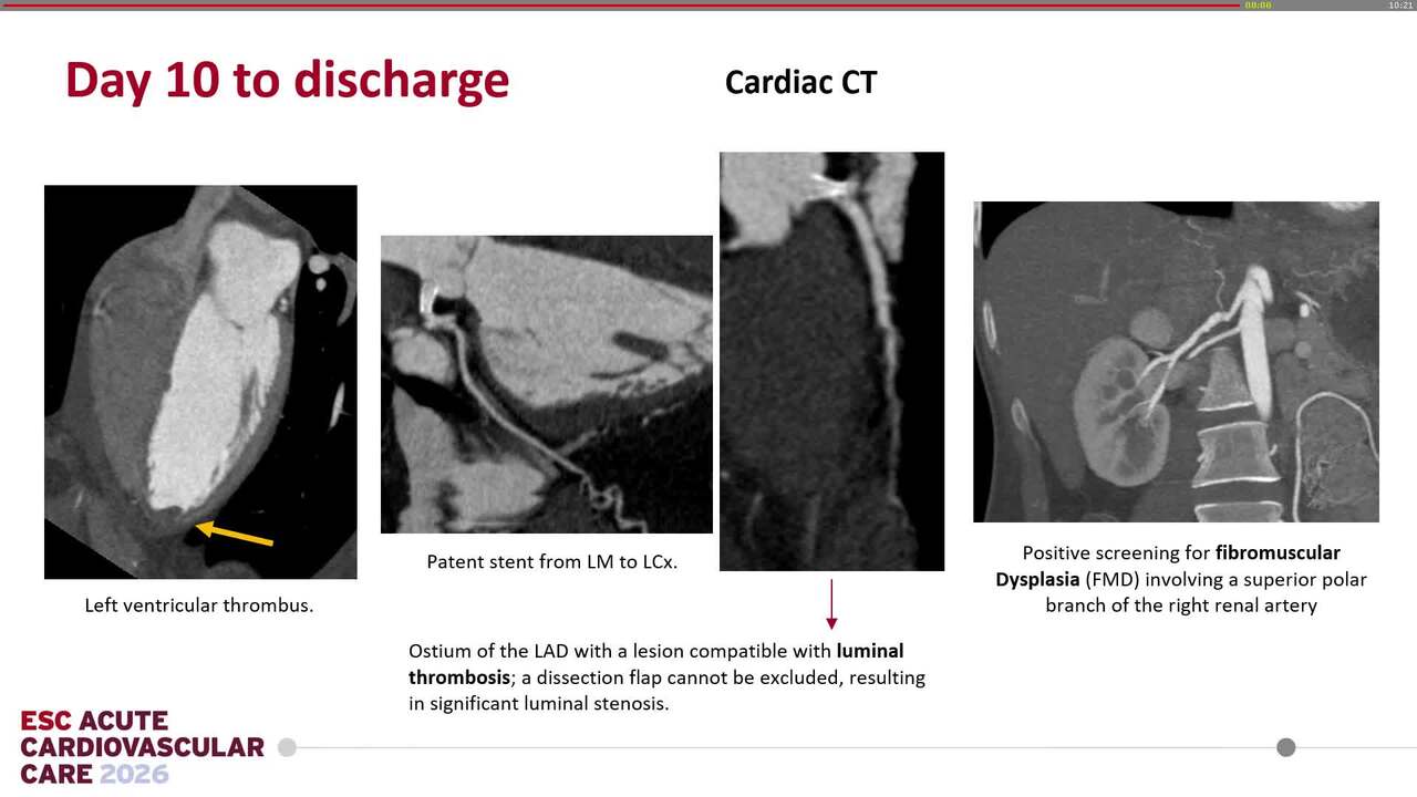 The ESC Heart Team at work: a presidential approach to an acute cardiac care patient’s journey