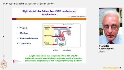 Practical aspects of ventricular assist devices
