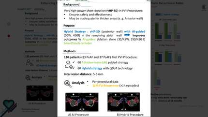 Enhancing efficiency in pulmonary vein isolation: hybrid high-power strategy with consistent long-term recurrence rates