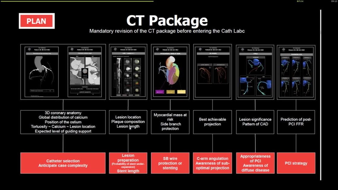 Ccta Device Guide ESC 365 - CCTA to guide coronary intervention