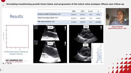 Circulating transforming growth factor-beta1 and progression of the mitral valve prolapse: fifteen-year follow-up