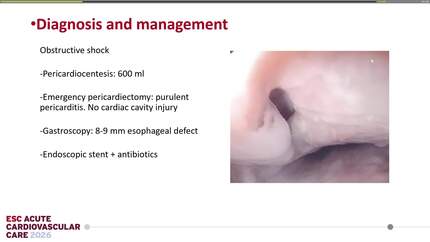 Presentation thumbnail
