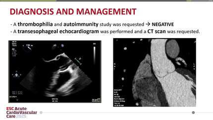 Presentation thumbnail