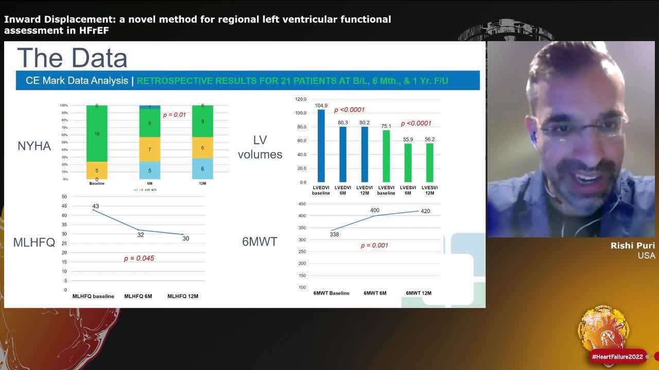 Inward Displacement: a novel method for regional left ventricular functional assessment in HFrEF
