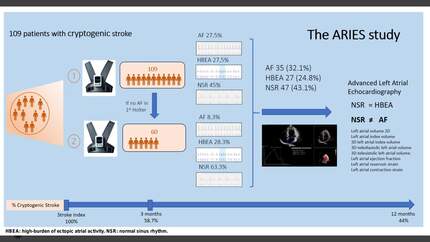 Atrial imaging and cardiac Rhythm In cryptogenic Embolic Stroke: the ARIES study