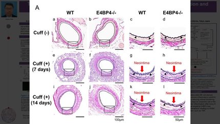 Transcription factor E4BP4 induces natural killer cell-derived inflammation and increases neointimal formation after vascular injury