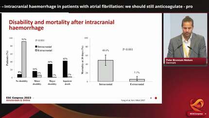 Great Debate: preventing stroke in carotid disease and intracranial haemorrhage