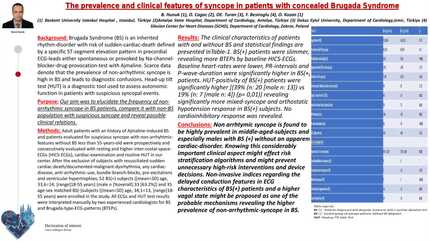 The prevalence and clinical features of syncope in patients with concealed Brugada Syndrome