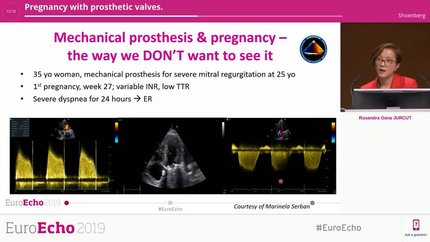 Presentation thumbnail