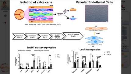 Aortic valve stenosis augments long noncoding RNA H19 to govern angiogenic responses and phenotypes of valvular endothelial cell through endothelial to mesenchymal transition