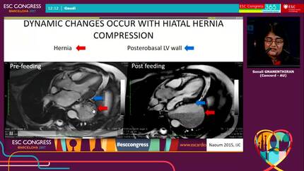 Presentation thumbnail
