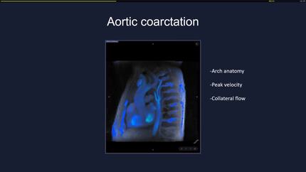 Presentation thumbnail
