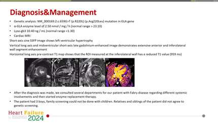 6p.R220L is a pathogenic novel GLA gene mutation responsible for a cardiac phenotype of Fabry disease