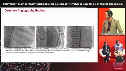Navigating complex anatomy: cases of congenital intervention