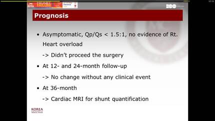 Aorta right atrial tunnel : do always need surgical correction?