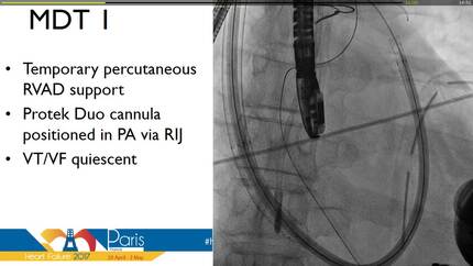 Presentation thumbnail