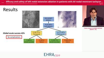 Efficacy and safety of left nodal extension ablation in patients with AV nodal reentrant tachycardia and right-sided ablation failure