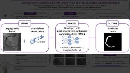 angioPy: an open-source, deep learning-driven tool for coronary artery segmentation