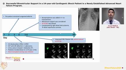 Successful Biventricular Support in a 14-year-old Cardiogenic Shock Patient in a Newly Established Advanced Heart failure Program.