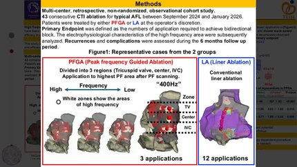 Peak frequency annotation identifies functional ablation targets in cavotricuspid isthmus-dependent atrial flutter 