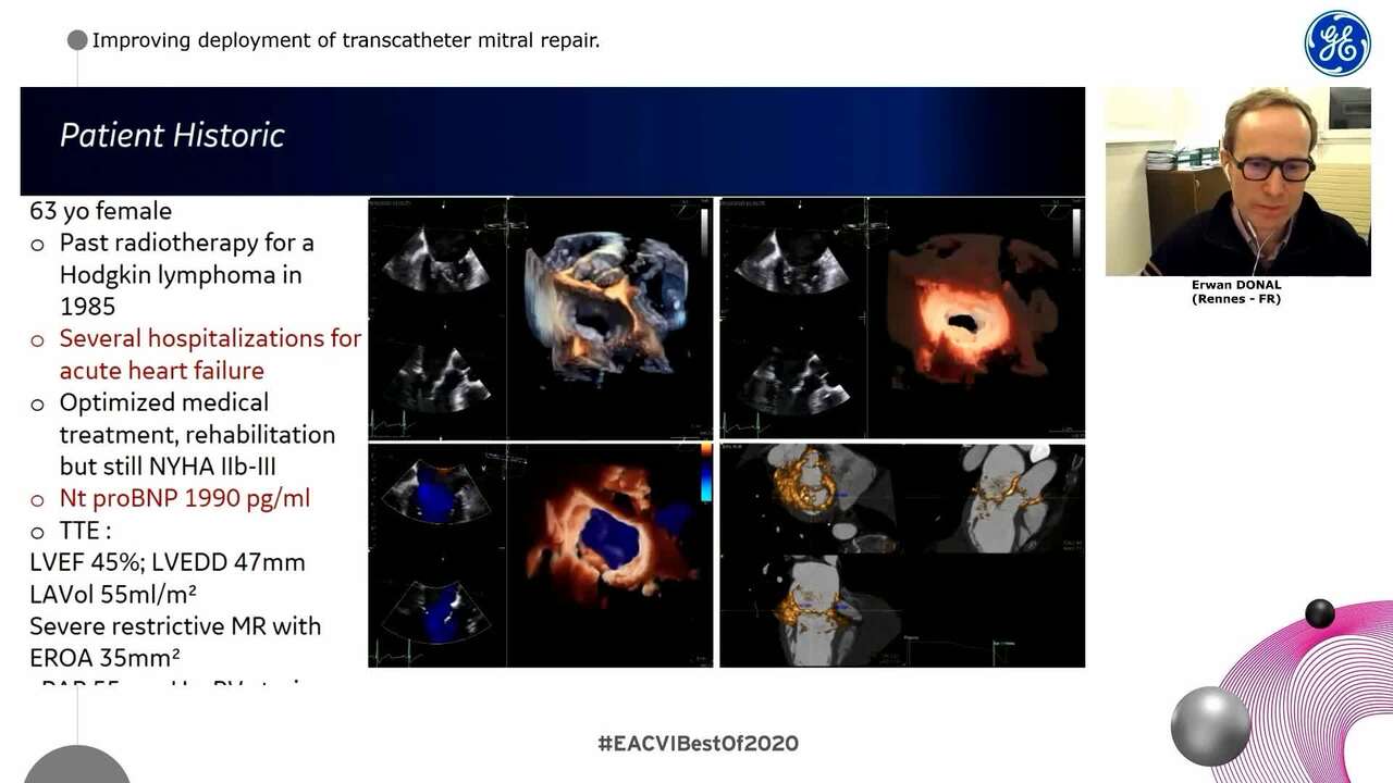 How can we make a  big step forward in the cath and echo labs