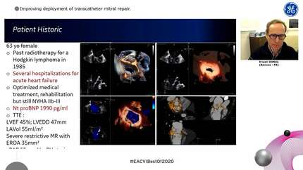 How can we make a  big step forward in the cath and echo labs