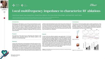 Local multifrequency impedance to characterize RF ablations.