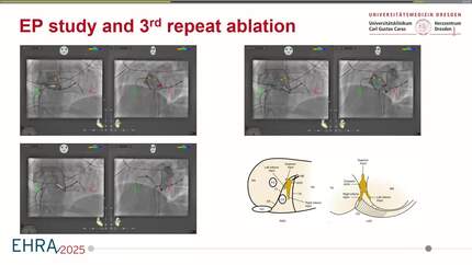 Presentation thumbnail