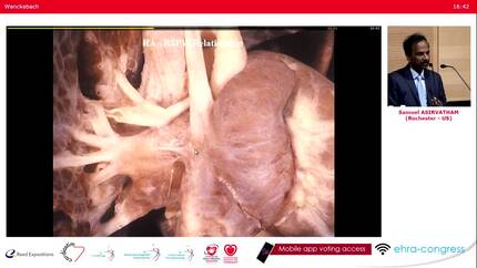 Lessons from the surface ECG